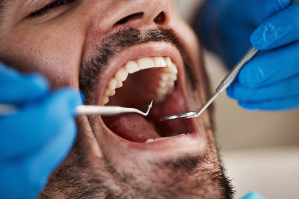 Best Urgent Dental Care for Toothaches in Benton Heights, MI